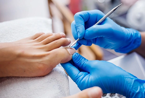 Онихолизис: причины появления и лечение